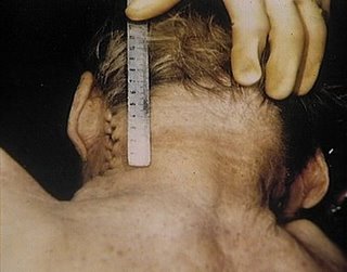 Rudolf Hess Alemania WWII militaria lagleize1944